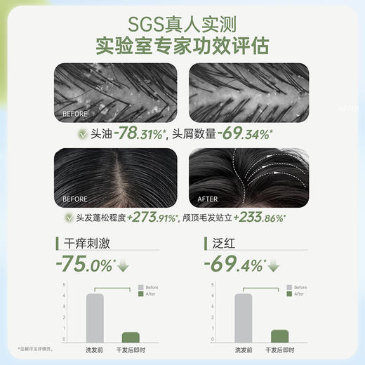 袋鼠妈妈 青少年去屑控油洗发水(清新白茶)380ml A100185505 商品图4