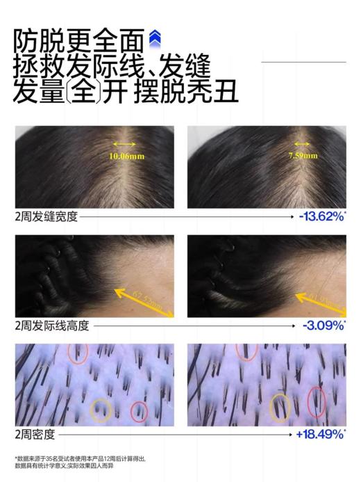 EHD 防脱防断固发洗发水300ml 护发组合 商品图1
