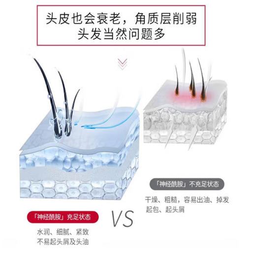 舒蕾 头皮舒爽控油去屑洗发露430ml 6973226725511 商品图4