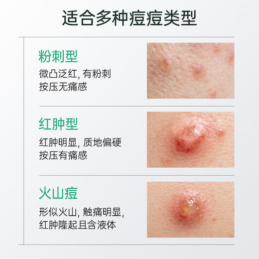 【余宇涵同款】膜法世家微生态祛痘修护纱布面膜 商品图4