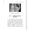 脊柱结核一体化治疗 夏平 冯晶 黄覓 周鹃 主编 一部聚焦脊柱结核中西医结合诊疗方案的专业书籍 9787513296984中国中医药出版社 商品缩略图4