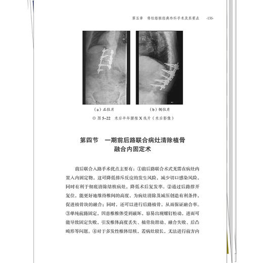 脊柱结核一体化治疗 夏平 冯晶 黄覓 周鹃 主编 一部聚焦脊柱结核中西医结合诊疗方案的专业书籍 9787513296984中国中医药出版社 商品图4