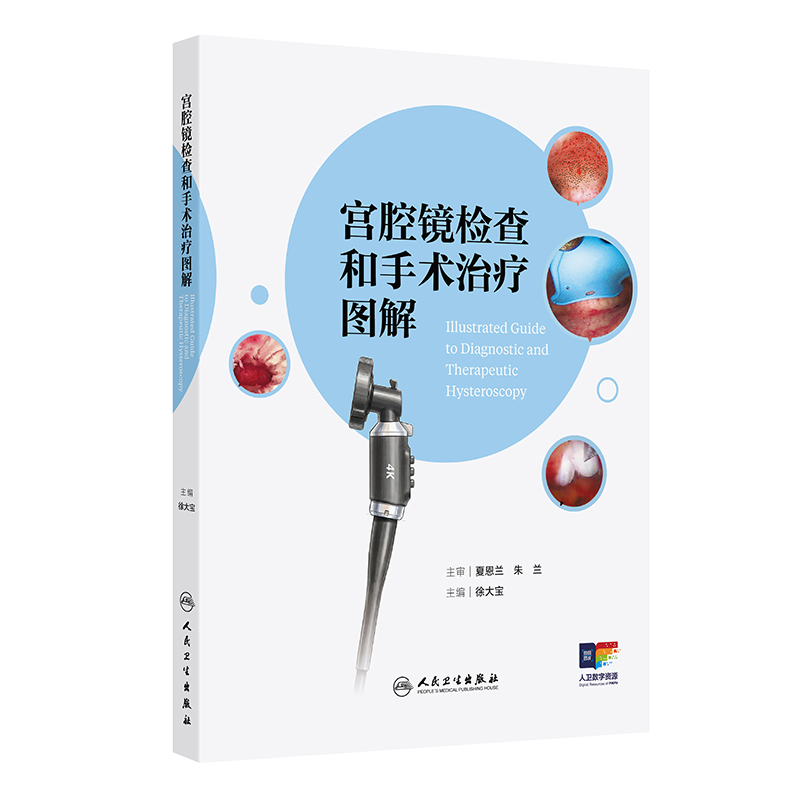 宫腔镜检查和手术治疗图解