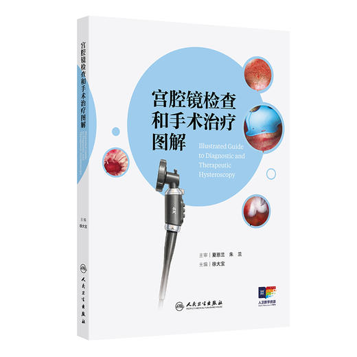 宫腔镜检查和手术治疗图解 商品图0