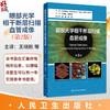 眼部光学相干断层扫描血管成像 第2二版 王晓刚 张正威 主译 一本与时俱进、内容丰富、贴合临床的实用性专业书籍 人民卫生出版社 商品缩略图0