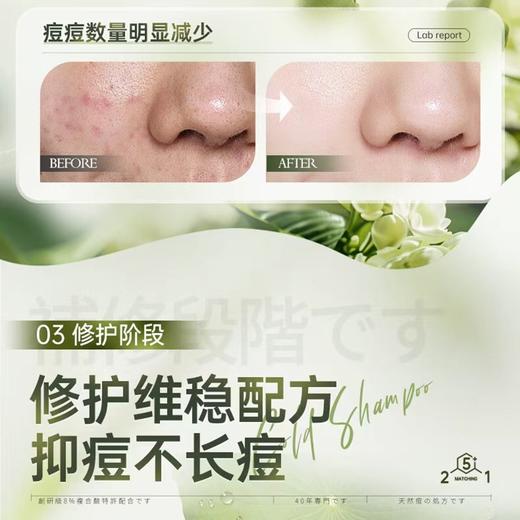 维特丝 愈创木焕活修护祛痘精华液30ml VXL8616 商品图3