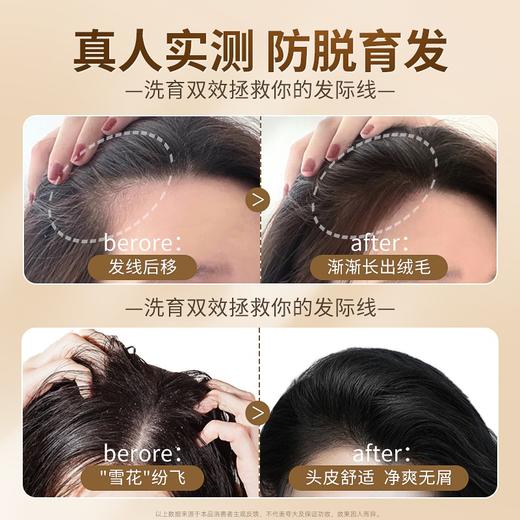 三个魔发匠 防脱精华洗发乳 200ml 6976218860214 商品图2