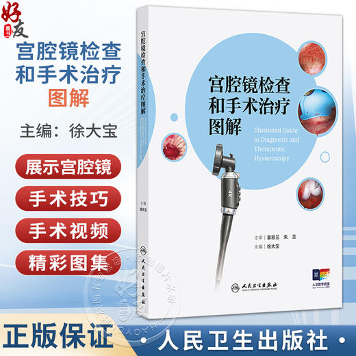 宫腔镜检查和手术治疗图解 徐大宝 主编 本书将采用纸数融合的形式 加入大量宫腔镜手术视频解读及精彩图集等 人民卫生出版社 商品图0