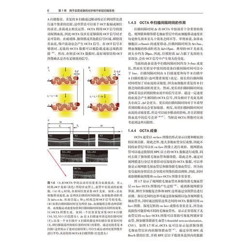 眼部光学相干断层扫描血管成像 第2二版 王晓刚 张正威 主译 一本与时俱进、内容丰富、贴合临床的实用性专业书籍 人民卫生出版社 商品图4