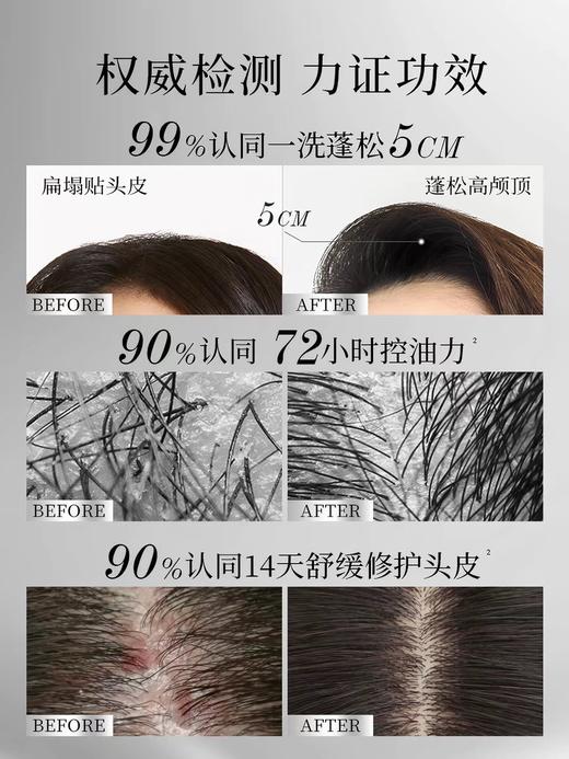 滋源控油绿极光洗发水蓬松轻盈去油修护洗发水535g效期29年（瓶身轻微磨损） 商品图4