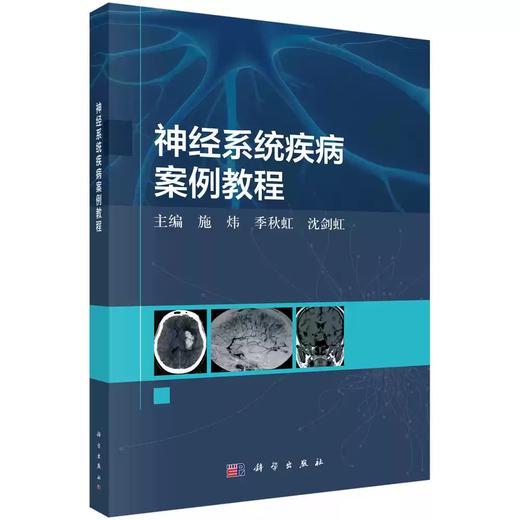 神经系统疾病案例教程 商品图0