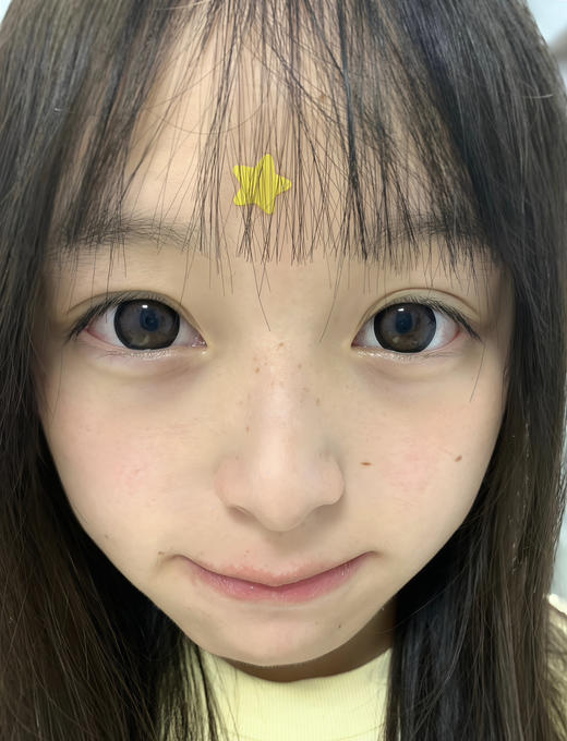 大直径推荐丨黑松沙士·Laseecon丨14.5mm（年抛/2片装） 商品图3