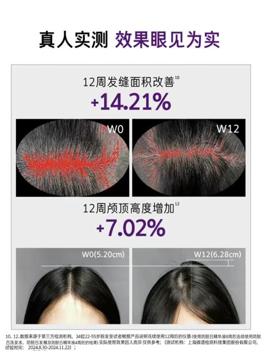 RYO吕防脱洗发水洗发露400ml   【首创毛囊级防脱管理】无硅油弱酸性 持证机构实测 商品图4