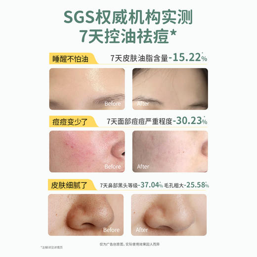 【TOP登陆少年组合同款】 控油祛痘 清洁黑头 袋鼠妈妈安肌清透雪泥洁面乳100g 商品图2