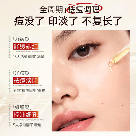 水杨酸祛痘精华液痘印痘坑控油修护淡化痘疤闭口粉刺黑头收缩毛孔|儒意官方商城 商品图2