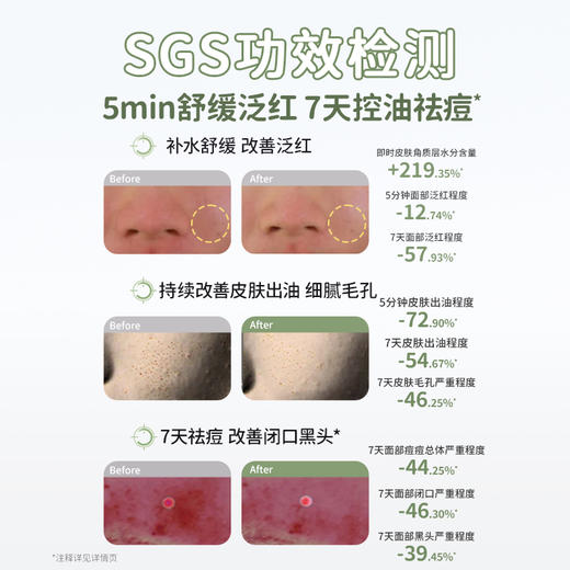 【青少年安肌3件套】补水控油改善冒痘 袋鼠妈妈青少年安肌护肤3件套（洁面+水+乳） 商品图2