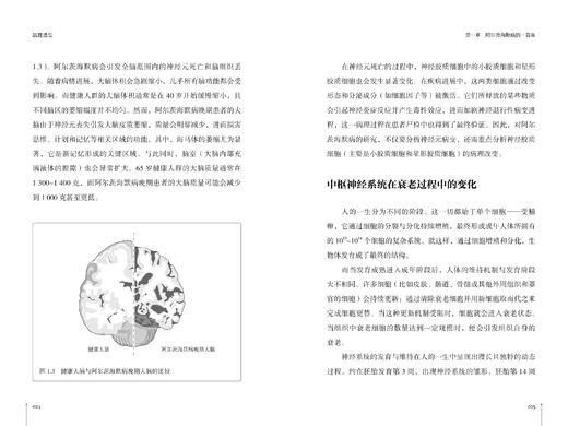 《战胜遗忘》 商品图2