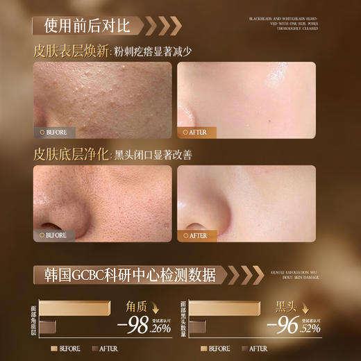 儒意净澈焕肤去角质啫喱150g  黄糖去角质面部死皮深层清洁毛孔去黑头男女士脸部啫喱官方旗舰店 商品图1