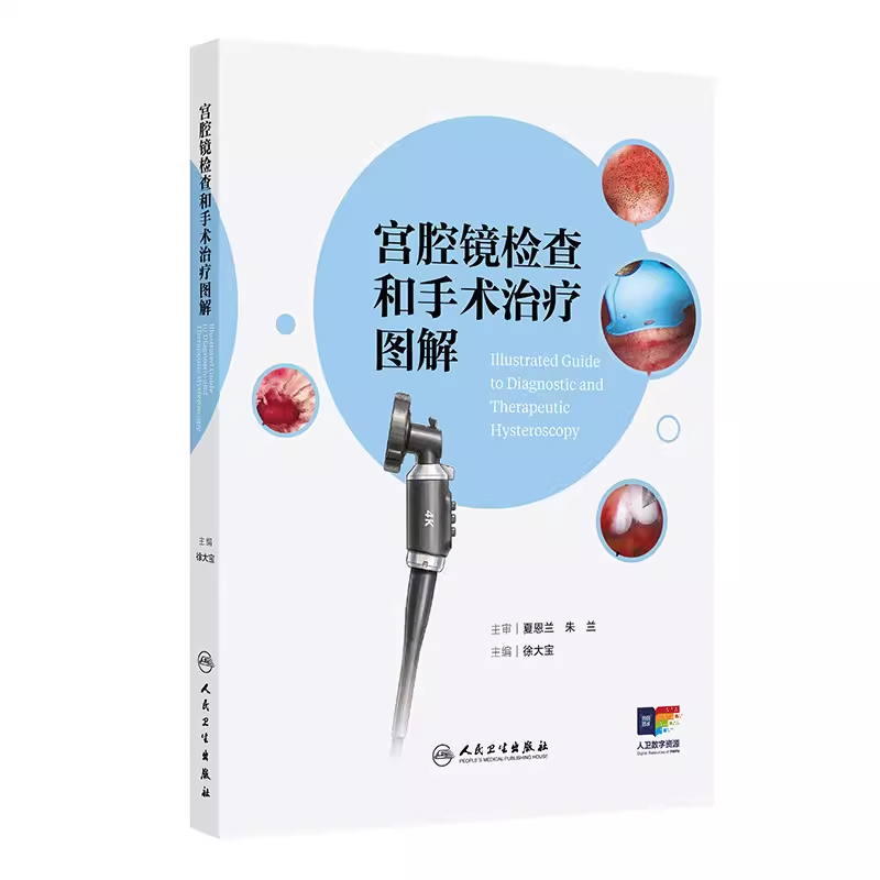（预售）宫腔镜检查和手术治疗图解   附大量宫腔镜手术视频解读及精彩图集等