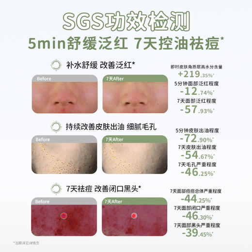 【青少年安肌4件套】补水控油改善冒痘 袋鼠妈妈青少年安肌护肤4件套（洁面+水+乳+面霜） 商品图3