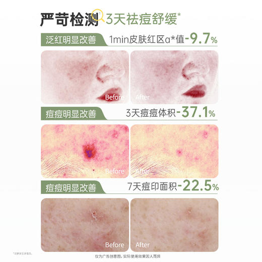 【青少年祛痘棉片】净痘闭口粉刺黑头 收缩毛孔 修护痘痘肌  无酸祛痘 祛痘修护棉片100片170ml 商品图3