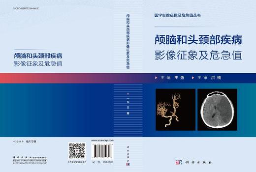 颅脑和头颈部疾病影像征象及危急值 王勇 9787030850324 商品图3
