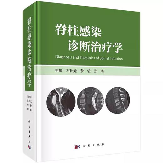 脊柱感染诊断治疗学 商品图0