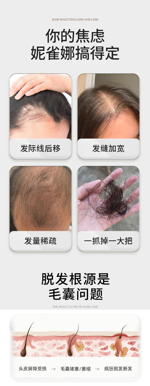 【私域专属】妮雀娜90颗低能量激光生发帽 商品图2