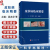 皮肤病临床精要 吴志华 吴大兴 吴丽峰 主编 适用于皮肤科医生 全科医生及医学生阅读 也可作为临床速查手册等 科学出版社 商品缩略图0