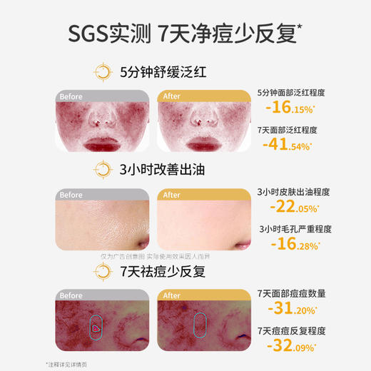 【祛痘沁透乳】控油祛痘 舒缓泛红 清爽保湿 深润快吸收 袋鼠妈妈安肌沁透乳100g 商品图3