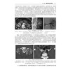 腹部和盆腔疾病影像诊断学 中文翻译版 杨汉丰 余晓雪 为影像科 临床医生提供全面且前沿的腹部和骨盆疾病诊断成像信息 科学出版社 商品缩略图4