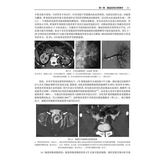 腹部和盆腔疾病影像诊断学 中文翻译版 杨汉丰 余晓雪 为影像科 临床医生提供全面且前沿的腹部和骨盆疾病诊断成像信息 科学出版社 商品图4