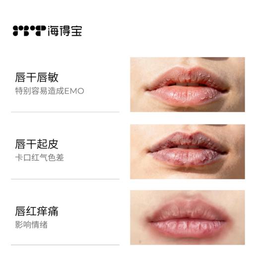 【海得宝专场】海得宝唇敏灰绷带 商品图1