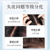 【头屑轻松搞定】二硫化硒去屑洗发露 300ml/盒 去屑洗发水净屑痒 商品缩略图3
