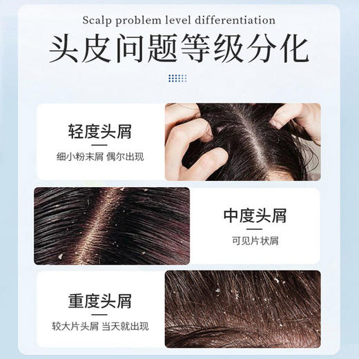 【头屑轻松搞定】二硫化硒去屑洗发露 300ml/盒 去屑洗发水净屑痒 商品图3