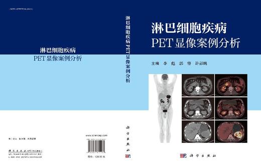 淋巴细胞疾病PET显像案例分析 9787030850201 李彪 郭睿 许彭鹏 商品图3