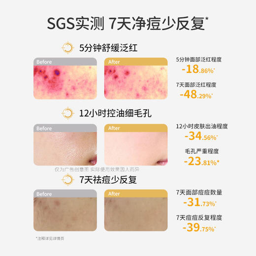 【祛痘净透水】补水控油 减少黑头 7天有效净痘改善反复 袋鼠妈妈安肌净透水120ml 商品图3