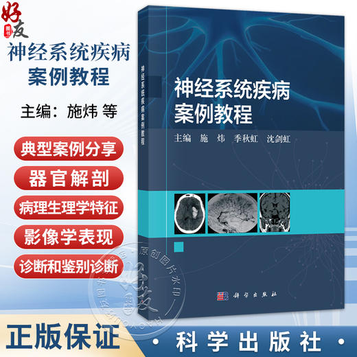 神经系统疾病案例教程 施炜 季秋虹 沈剑虹 主编 本教程适合临床医学专业本科生、住院医师规范化培训学生及研究生使用 科学出版社 商品图0