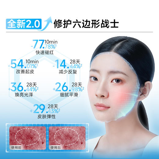 【三重蛋白面膜2.0全新上市❗️】10min速褪红 强修护少反复 舒缓敏感褪红少反复 油痘肌/敏肌护肤 商品图3