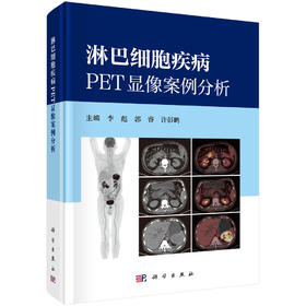 淋巴细胞疾病PET显像案例分析 9787030850201 李彪 郭睿 许彭鹏