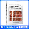 新书预售 5月11日发货《大肠炎症性疾病诊断与鉴别诊断图谱》 商品缩略图1