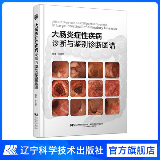 新书预售 5月11日发货《大肠炎症性疾病诊断与鉴别诊断图谱》 商品图1