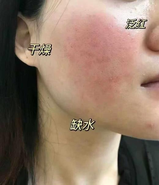 欧莱雅复颜玻尿酸水光充盈导入淡纹膨润面膜补水保湿提亮肤色 商品图3