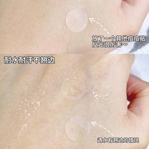 科诗玛美颜祛痘贴绿痘痘贴-纪念日百货门店同款171346858 商品图3