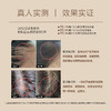 拯救发际线！UNILIPO研知有理特证版防脱固发头皮精华乳60ml*1瓶 商品缩略图2