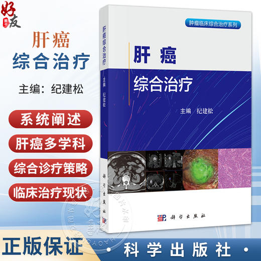 肝癌综合治疗 纪建松 主编 肿瘤临床综合治疗系列 本书适合肿瘤相关医疗工作者、科研人员及相关领域从业者阅读参考 科学出版社 商品图0