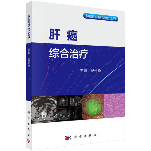 肝癌综合治疗 纪建松 主编 肿瘤临床综合治疗系列 本书适合肿瘤相关医疗工作者、科研人员及相关领域从业者阅读参考 科学出版社 商品图1