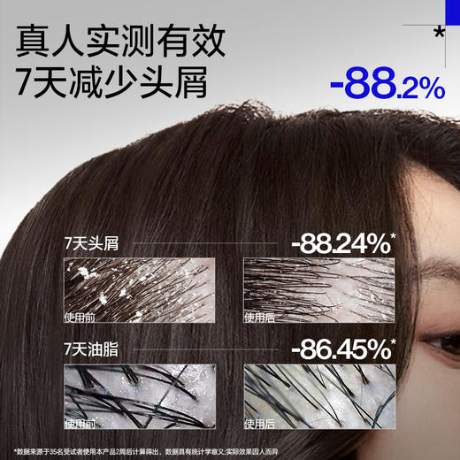 《控油去屑》EHD专研洗发水500ml*2瓶 下单就送防脱100ml*1（赠品送完为止） 商品图1