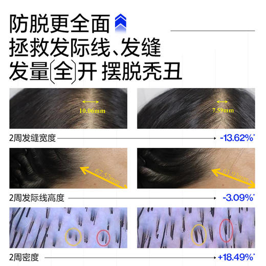 《防断固发》EHD防脱洗发水500ml*2瓶 下单就送防脱100ml*1（赠品送完为止） 商品图3
