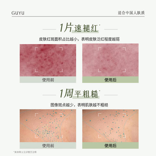 谷雨积雪绒花密集修护精华乳敷面膜-纪念日百货门店同款171151145 商品图2
